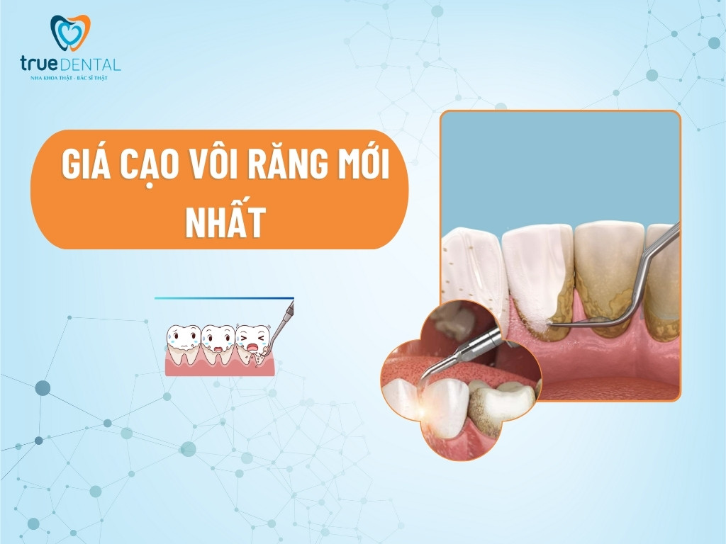 giá cạo vôi răng mới nhất