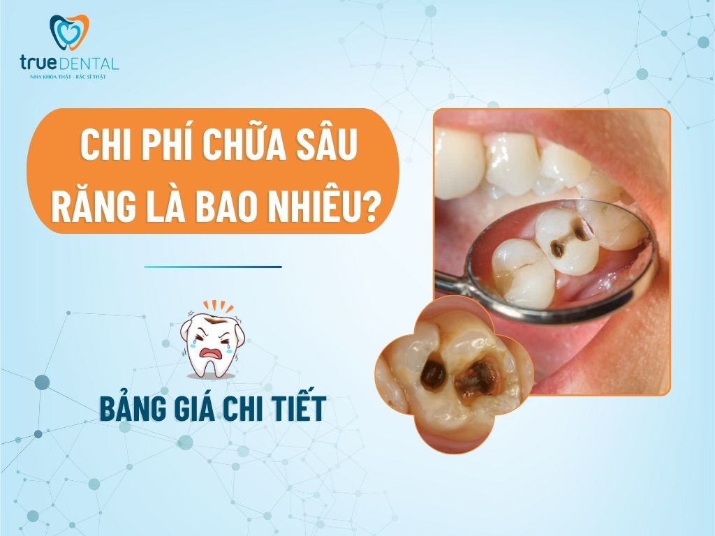 gia chua sau rang 1