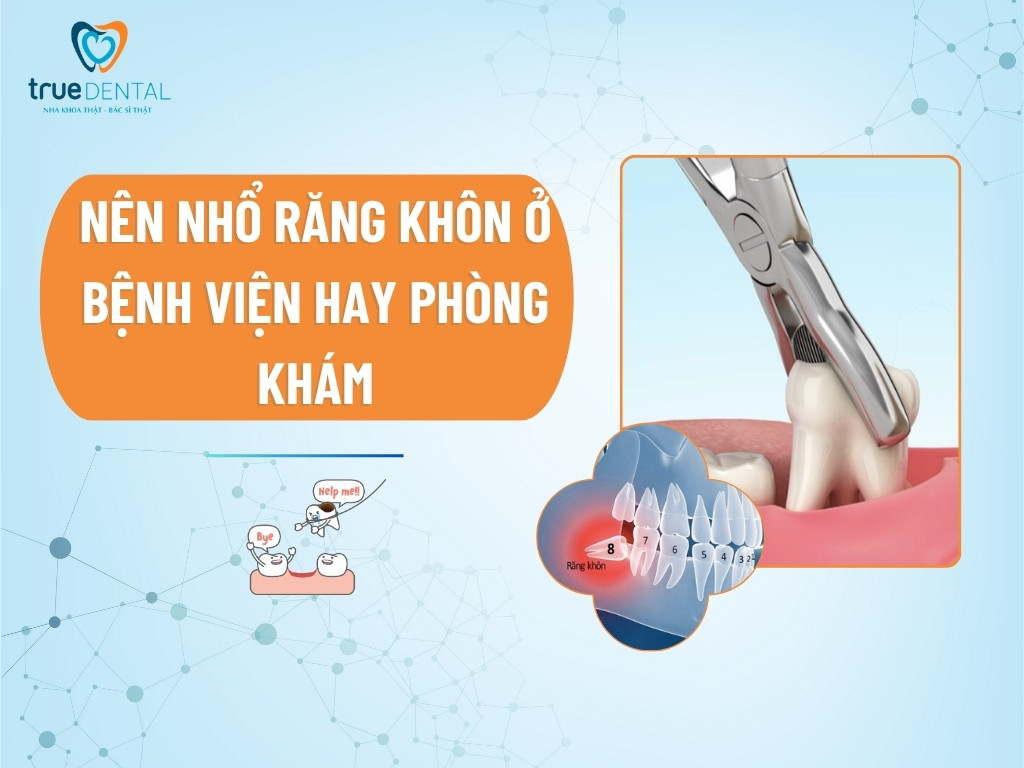 Nên nhổ răng khôn ở bệnh viện hay phòng khám
