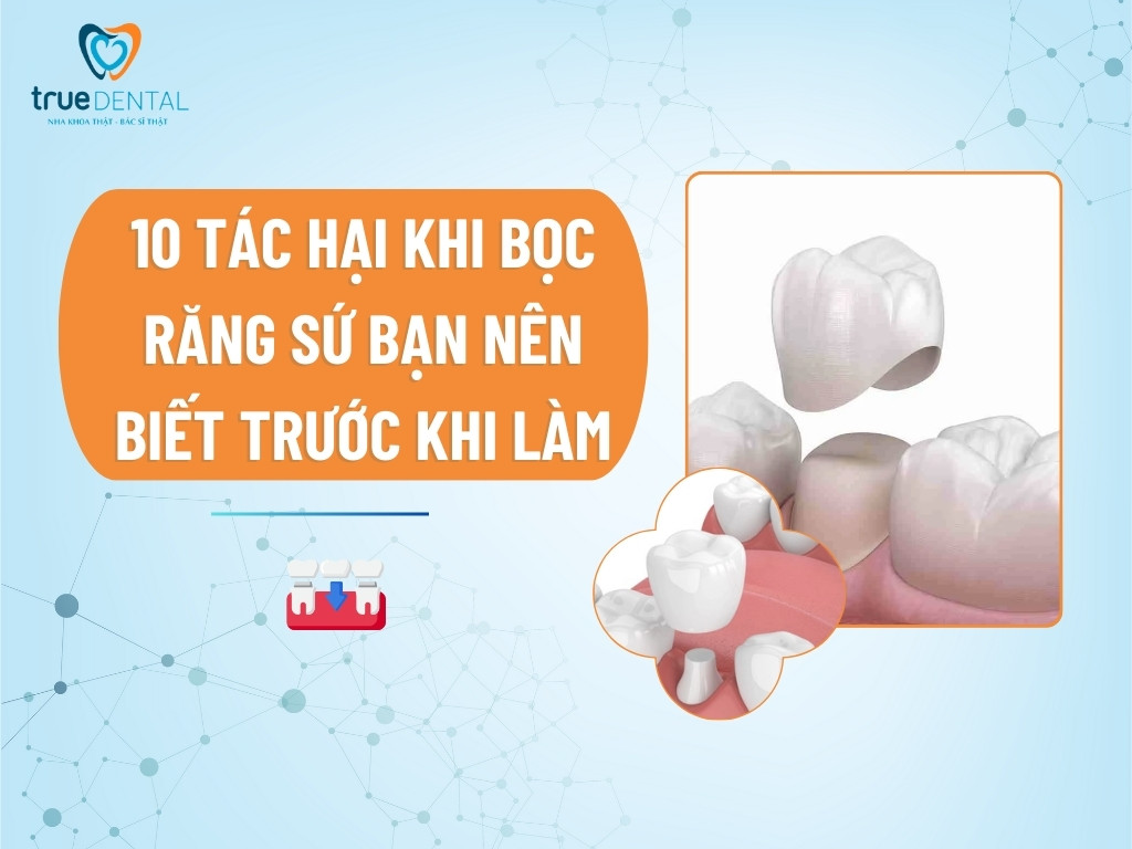 10 Tác hại bọc răng sứ bạn nên biết trước khi làm
