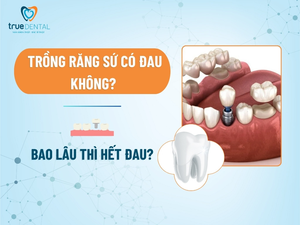 Trồng răng sứ có đau không? Bao lâu thì hết đau?