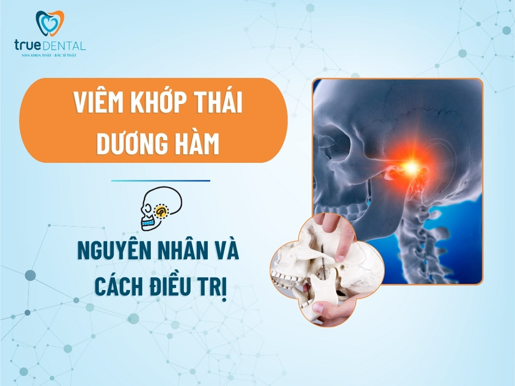 Viêm khớp thái dương hàm: Nguyên nhân và cách điều trị