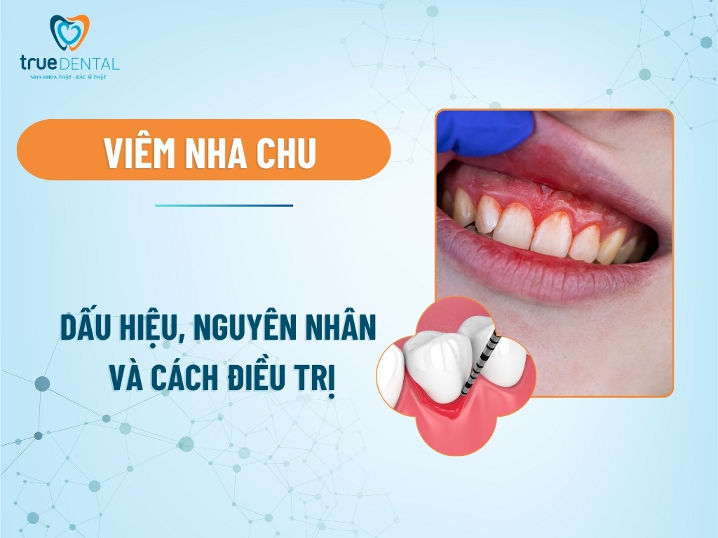viem nha chu 1