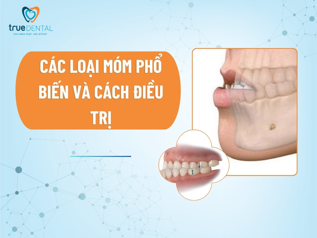 Các loại móm phổ biến và cách điều trị