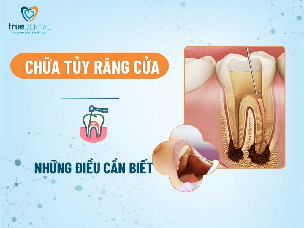 chua tuy rang cua 1