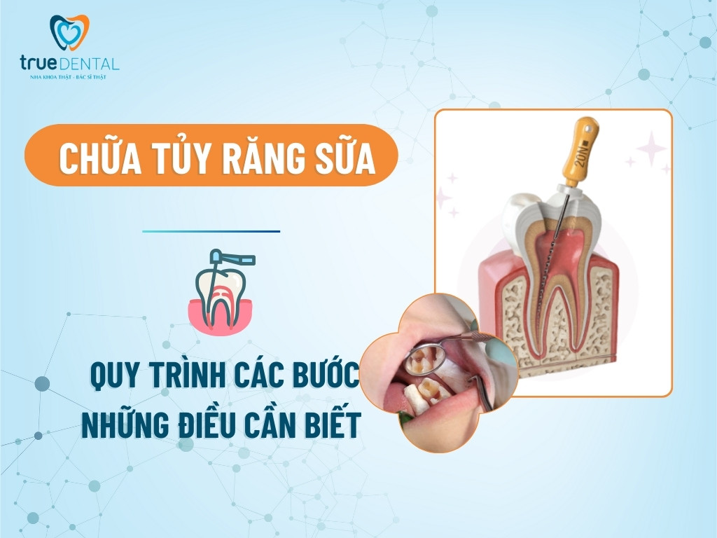 chua tuy rang sua 1