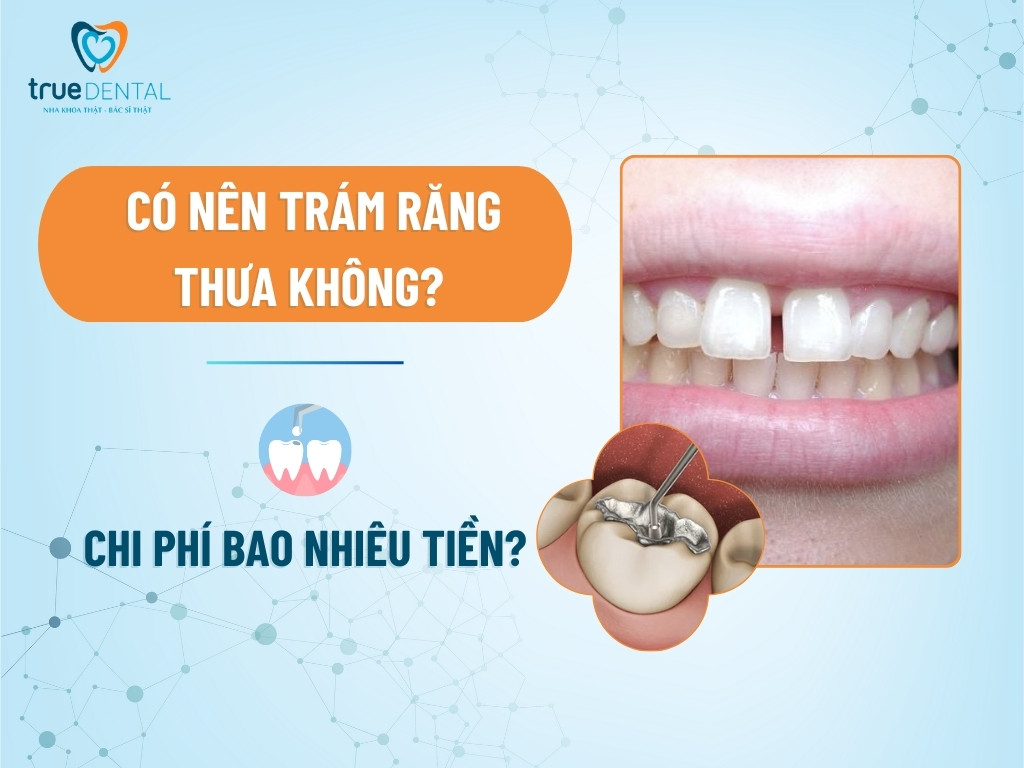 co nen tram rang thua khong 1