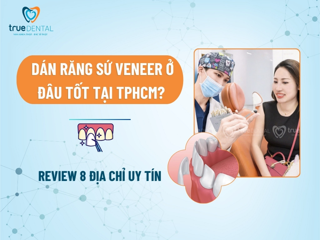 Dán răng sứ veneer ở đâu tốt tại TPHCM? Review 8 địa chỉ uy tín