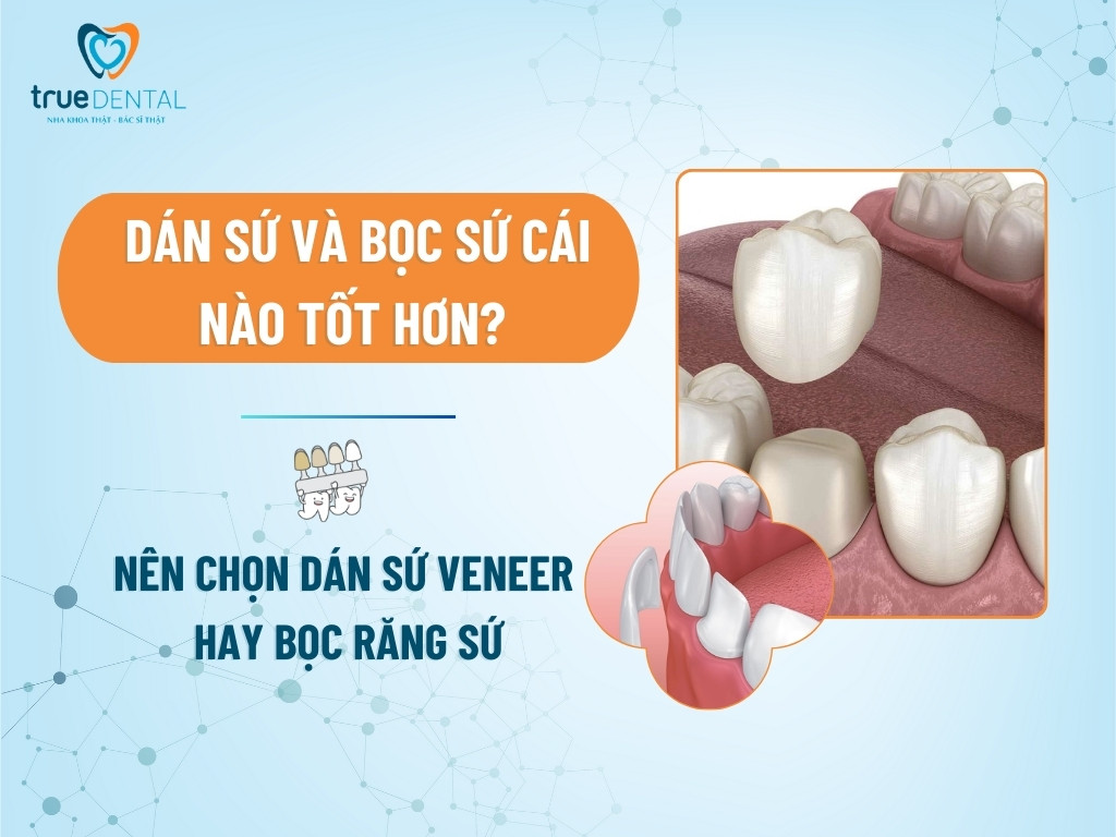 dan su va boc su 1
