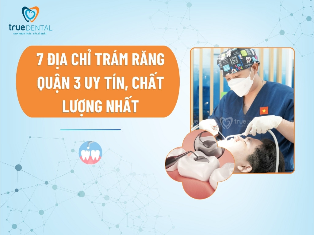 7 địa chỉ trám răng quận 3 uy tín, chất lượng nhất