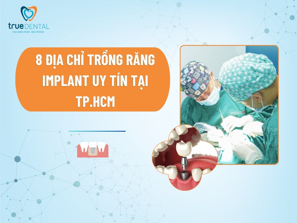8 địa chỉ trồng răng Implant uy tín tại TP.HCM