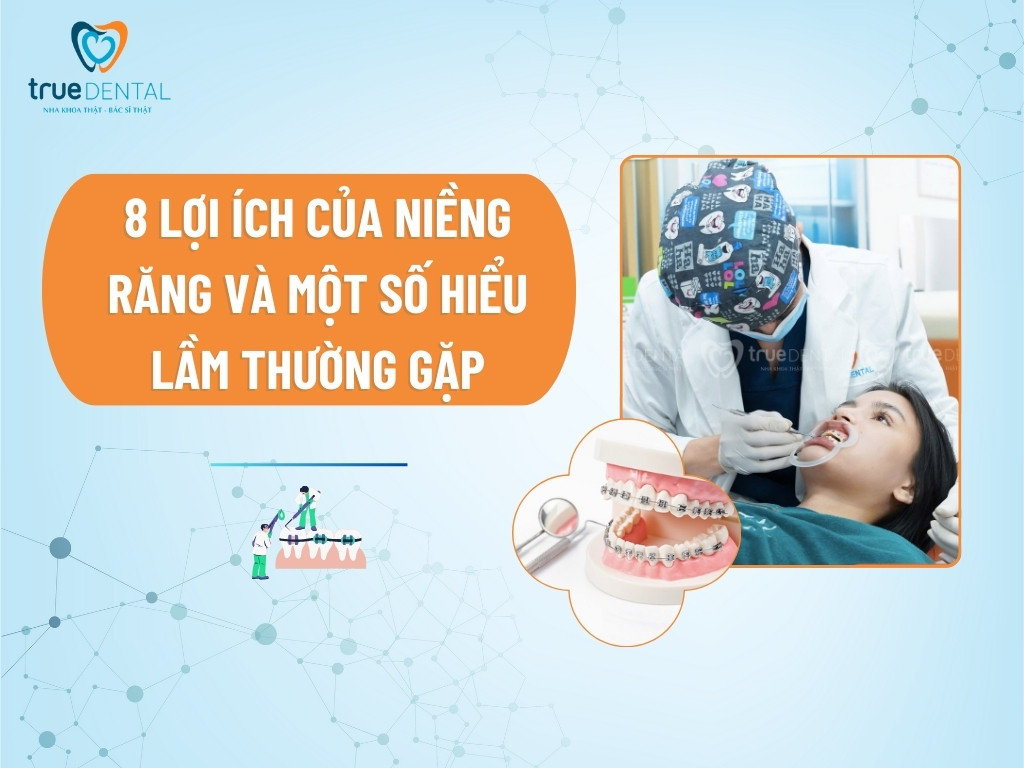 8 lợi ích của niềng răng và một số hiểu lầm thường gặp