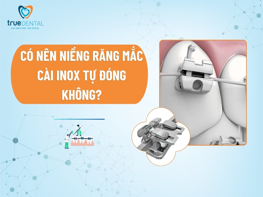 mac cai inox tu dong 1