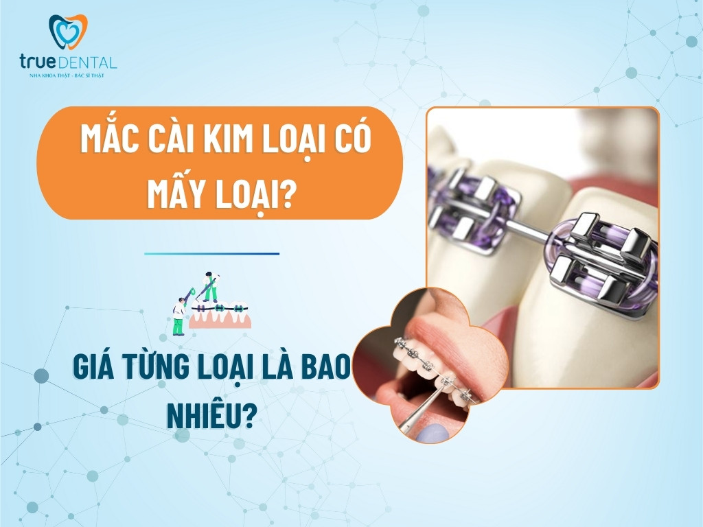 mac cai kim loai co may loai 1