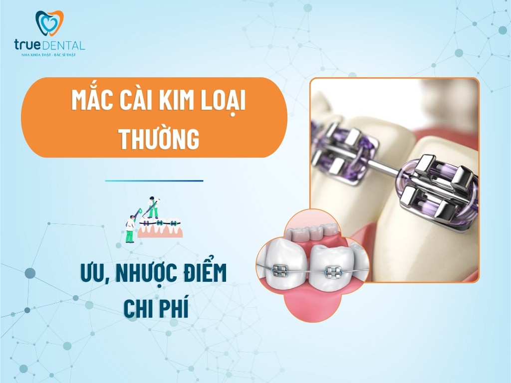 mac cai kim loai thuong 1 1