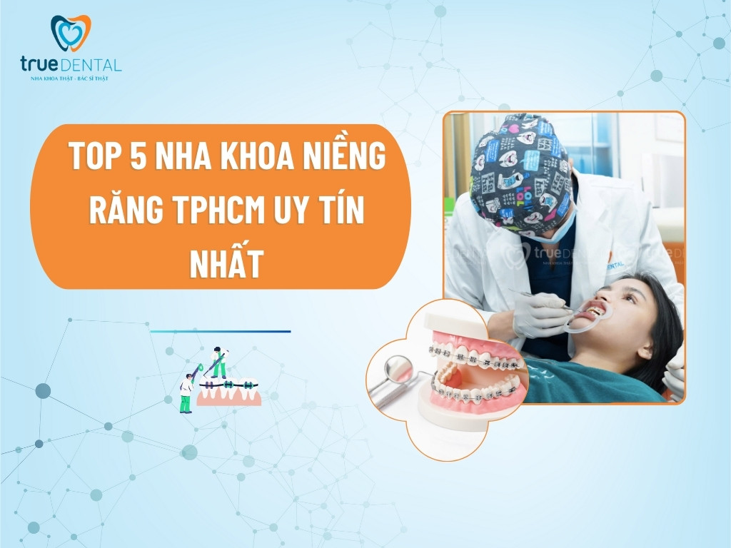 nha khoa nieng rang tphcm 1