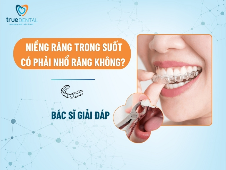 Niềng răng trong suốt có phải nhổ răng không? - Bác sĩ giải đáp 1 Niềng răng trong suốt có phải nhổ răng không? - Bác sĩ giải đáp