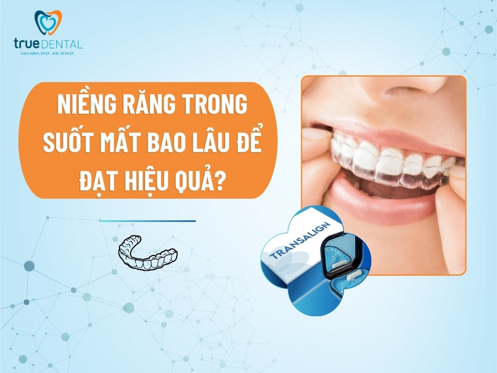 Niềng răng trong suốt mất bao lâu để đạt hiệu quả? 4 Niềng răng trong suốt mất bao lâu để đạt hiệu quả?