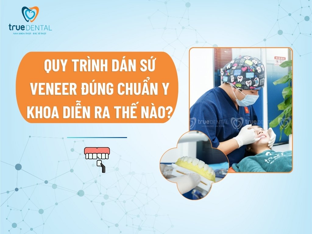 Quy trình dán sứ Veneer đúng chuẩn Y khoa diễn ra thế nào?