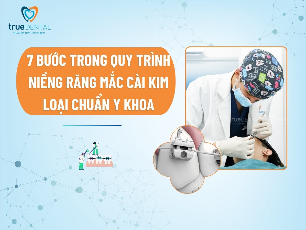 7 bước trong quy trình niềng răng mắc cài kim loại chuẩn Y khoa 3 7 bước trong quy trình niềng răng mắc cài kim loại chuẩn Y khoa