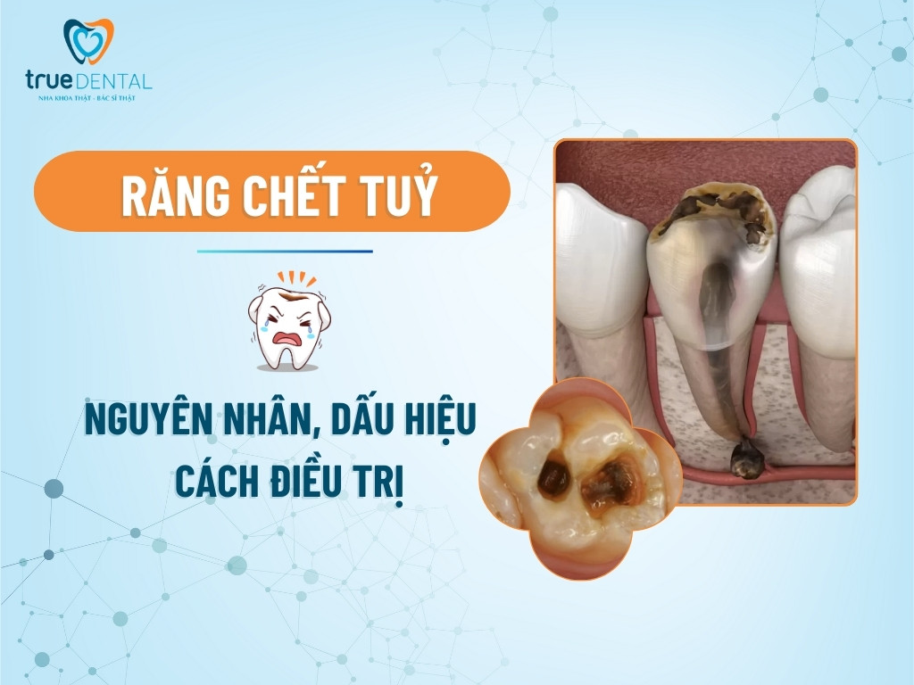 rang chet tuy 1