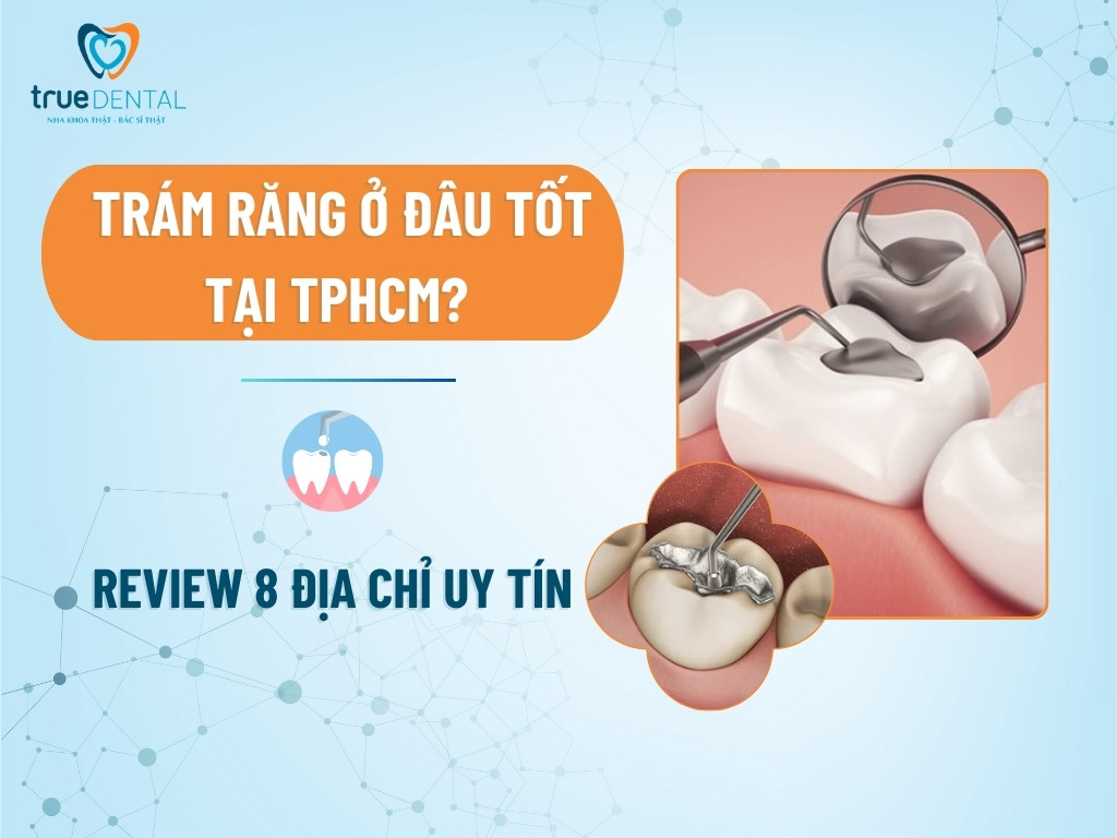 Trám răng ở đâu tốt tại TPHCM? Review 8 địa chỉ uy tín