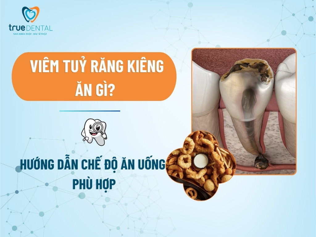 Viêm tuỷ răng kiêng ăn gì? Hướng dẫn chế độ ăn uống phù hợp