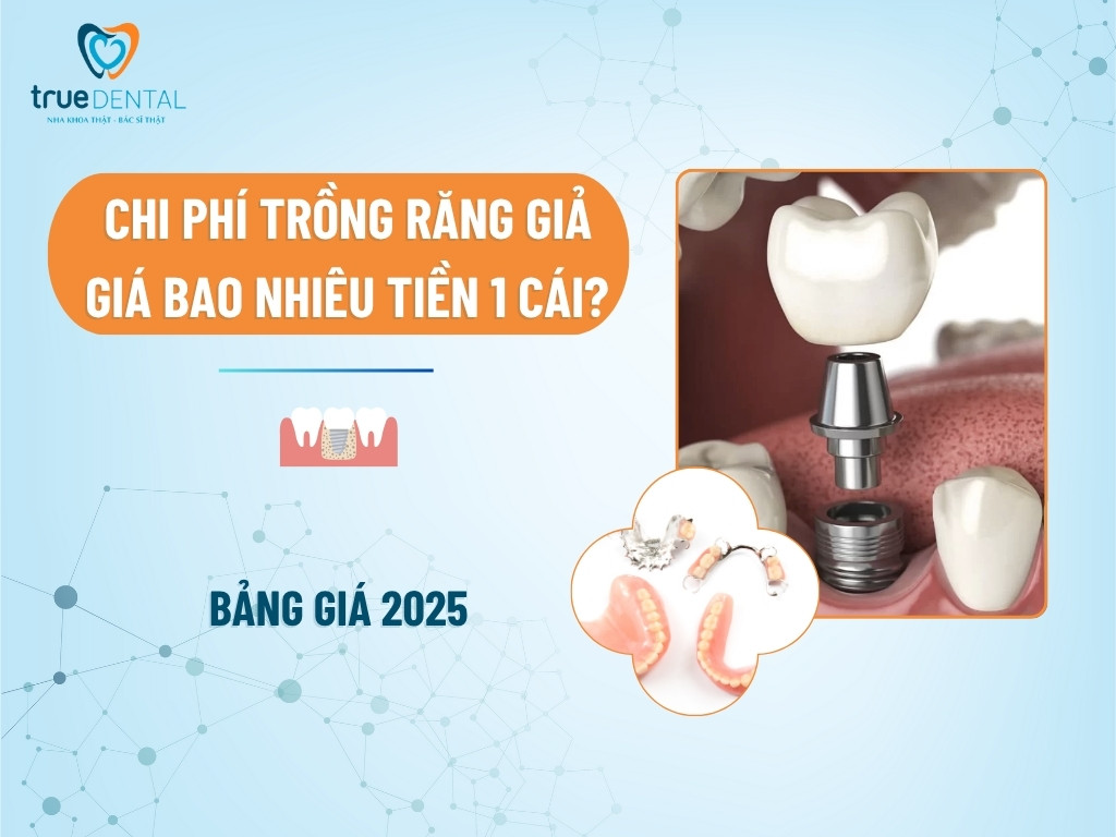 Chi phí trồng răng giả giá bao nhiêu tiền 1 cái? Bảng giá 2025