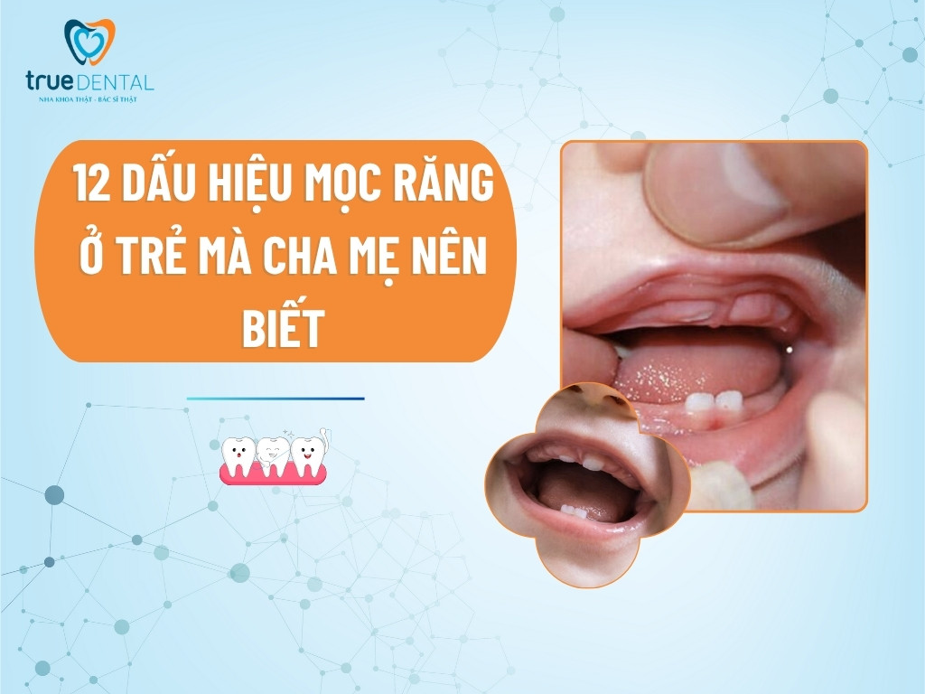 12 dấu hiệu mọc răng ở trẻ mà cha mẹ nên biết