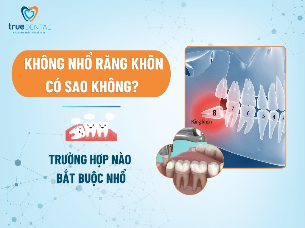 Không nhổ răng khôn có sao không? Trường hợp nào bắt buộc nhổ