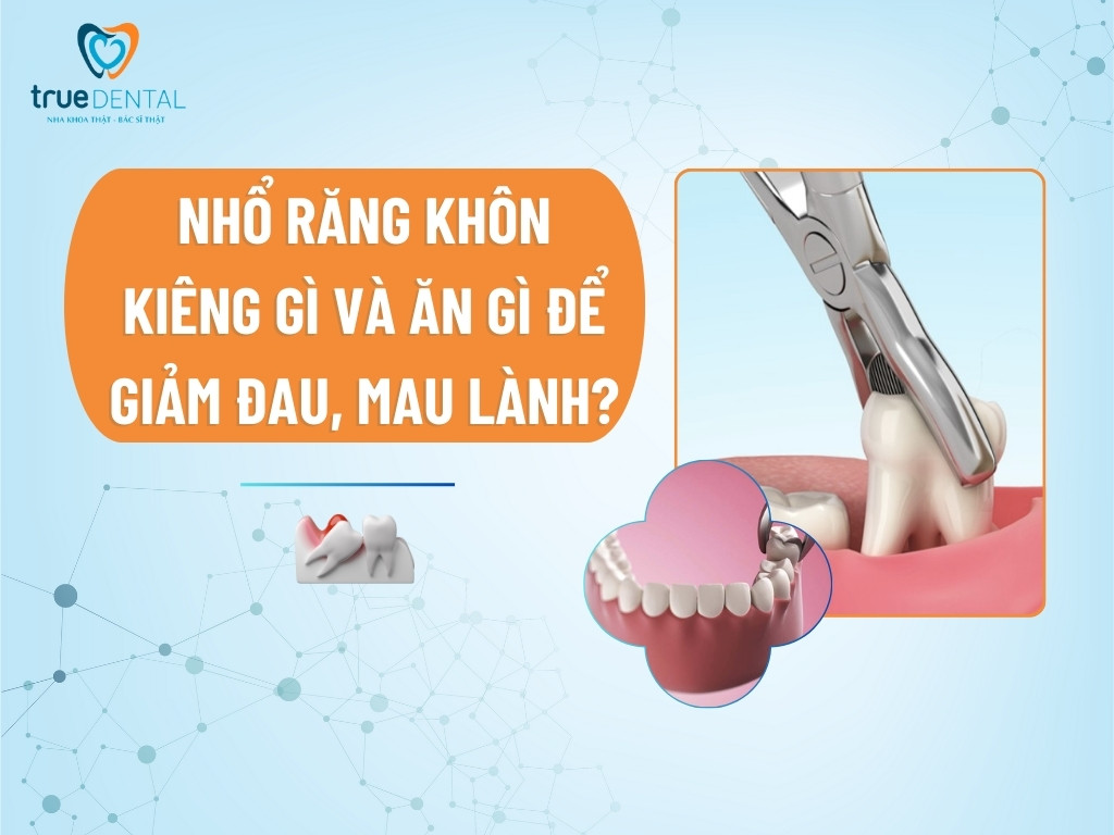 Nhổ răng khôn kiêng gì và ăn gì để giảm đau, mau lành?