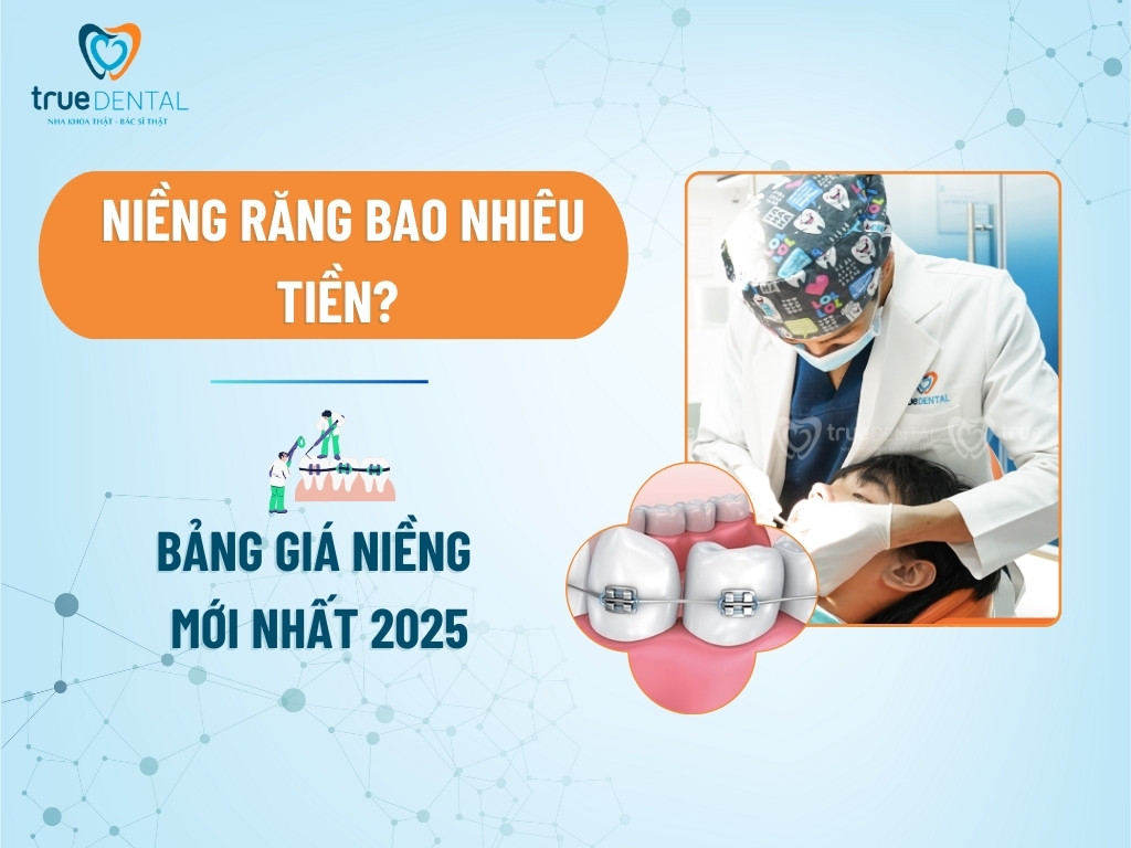Niềng răng bao nhiêu tiền? Bảng giá niềng mới nhất 2026 1 Niềng răng bao nhiêu tiền? Bảng giá niềng mới nhất 2025