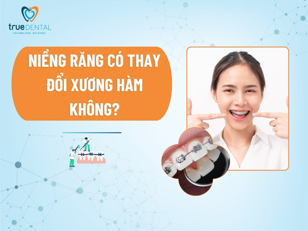 [Giải đáp] Niềng răng có thay đổi xương hàm không?