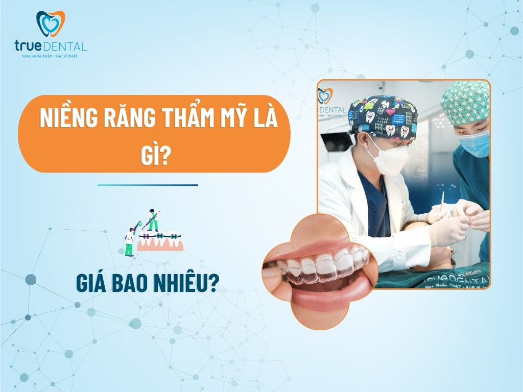 Niềng răng thẩm mỹ là gì? Giá bao nhiêu? 8 Niềng răng thẩm mỹ là gì? Giá bao nhiêu?