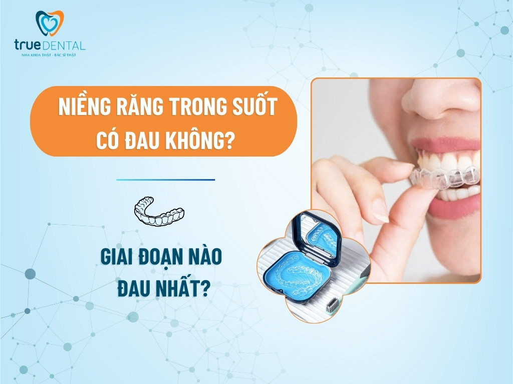 Niềng răng trong suốt có đau không? Giai đoạn nào đau nhất? 10 Niềng răng trong suốt có đau không? Giai đoạn nào đau nhất?