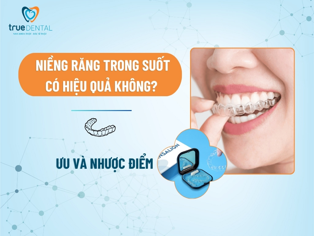 Niềng răng trong suốt có hiệu quả không? Ưu và nhược điểm 7 Niềng răng trong suốt có hiệu quả không? Ưu và nhược điểm