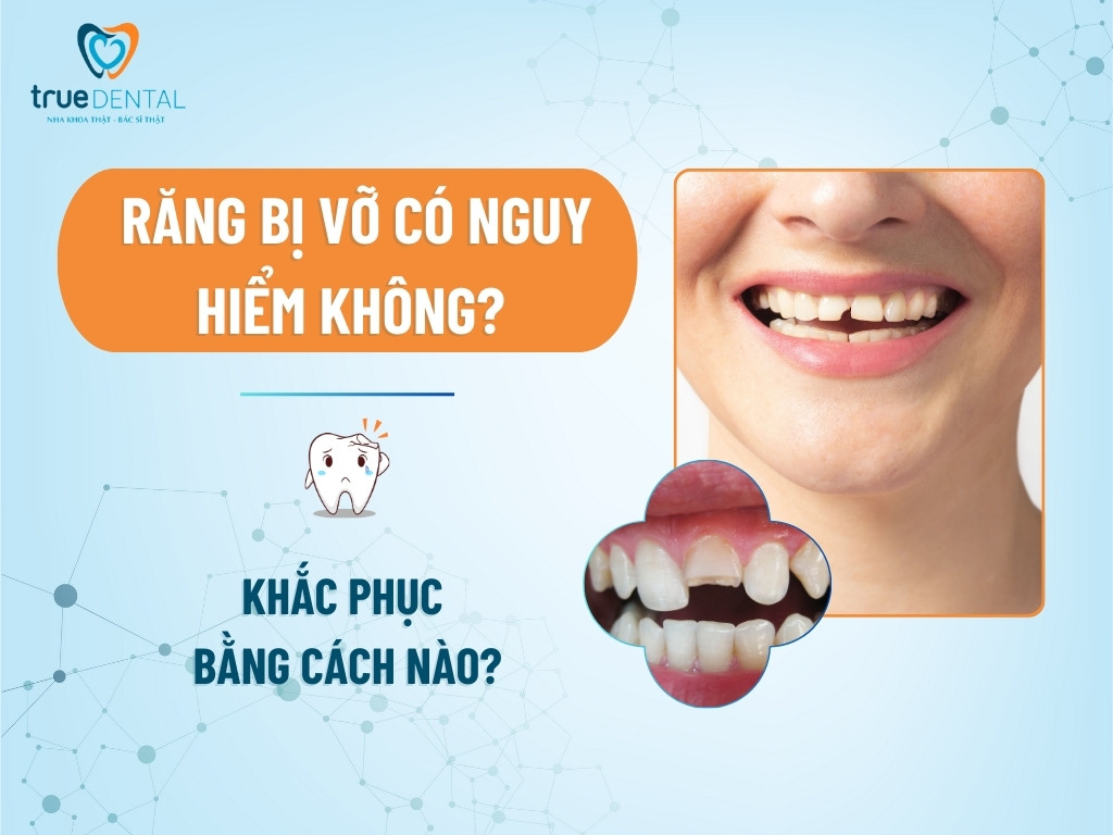 Răng bị vỡ có nguy hiểm không? Khắc phục bằng cách nào? 1 rang bi vo co nguy hiem khong 1