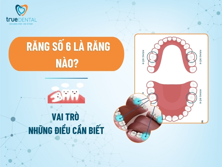 Răng số 6 là răng nào? Vai trò và những điều cần biết