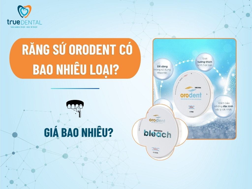 Răng sứ Orodent có bao nhiêu loại? Giá bao nhiêu?