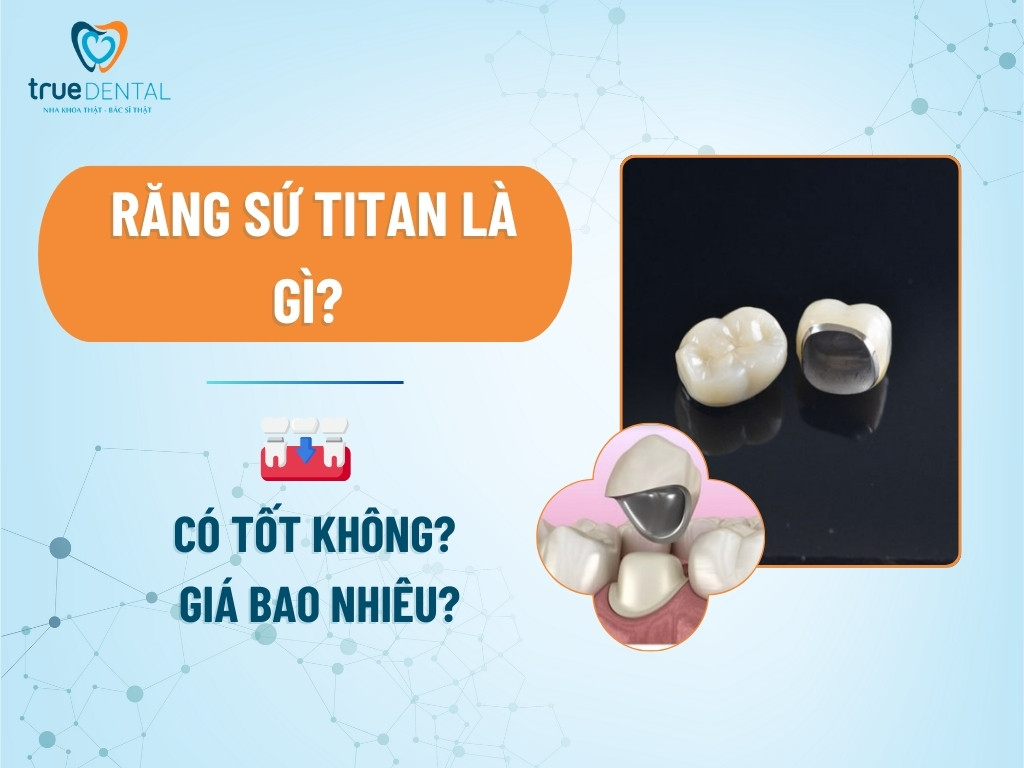Răng sứ Titan là gì? Có tốt không? Giá bao nhiêu?