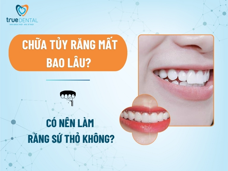 Răng thỏ là gì? Có nên làm răng sứ thỏ không?