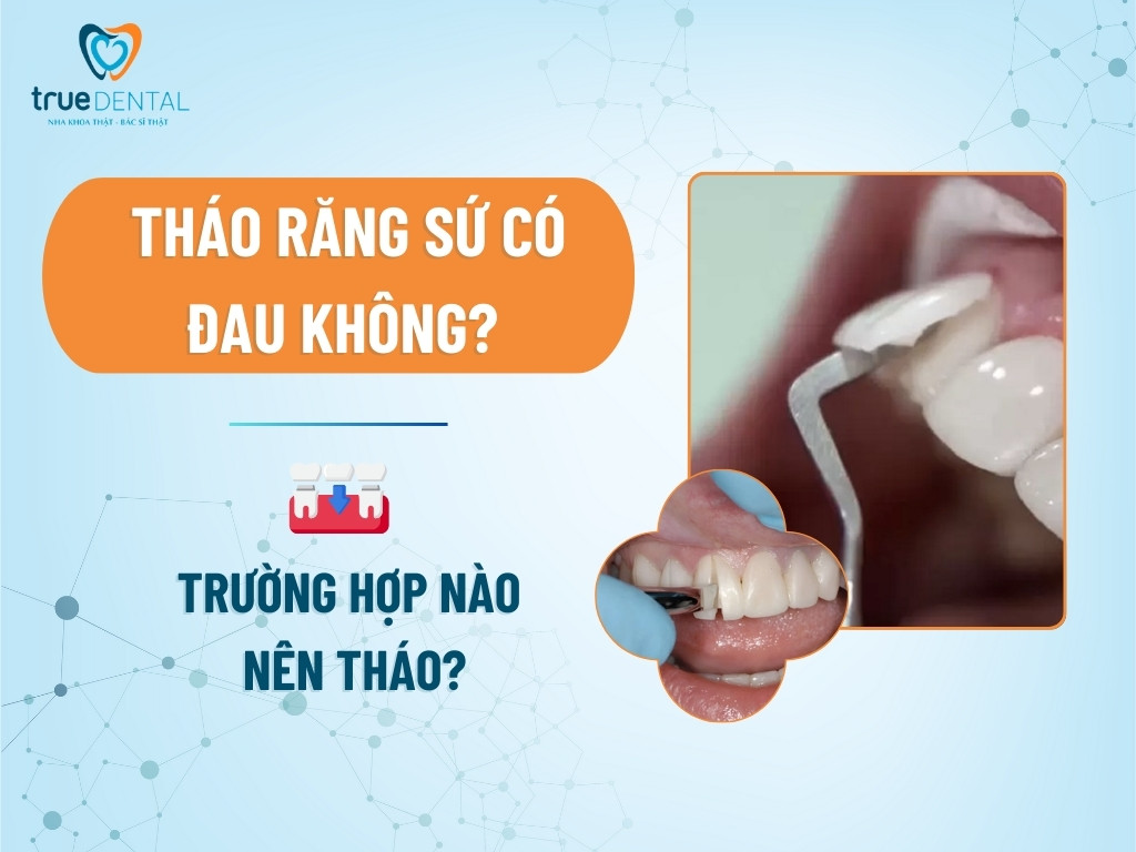 Tháo răng sứ có đau không? Trường hợp nào nên tháo?