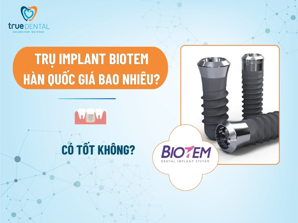 Trụ implant Biotem Hàn Quốc giá bao nhiêu? Có tốt không?