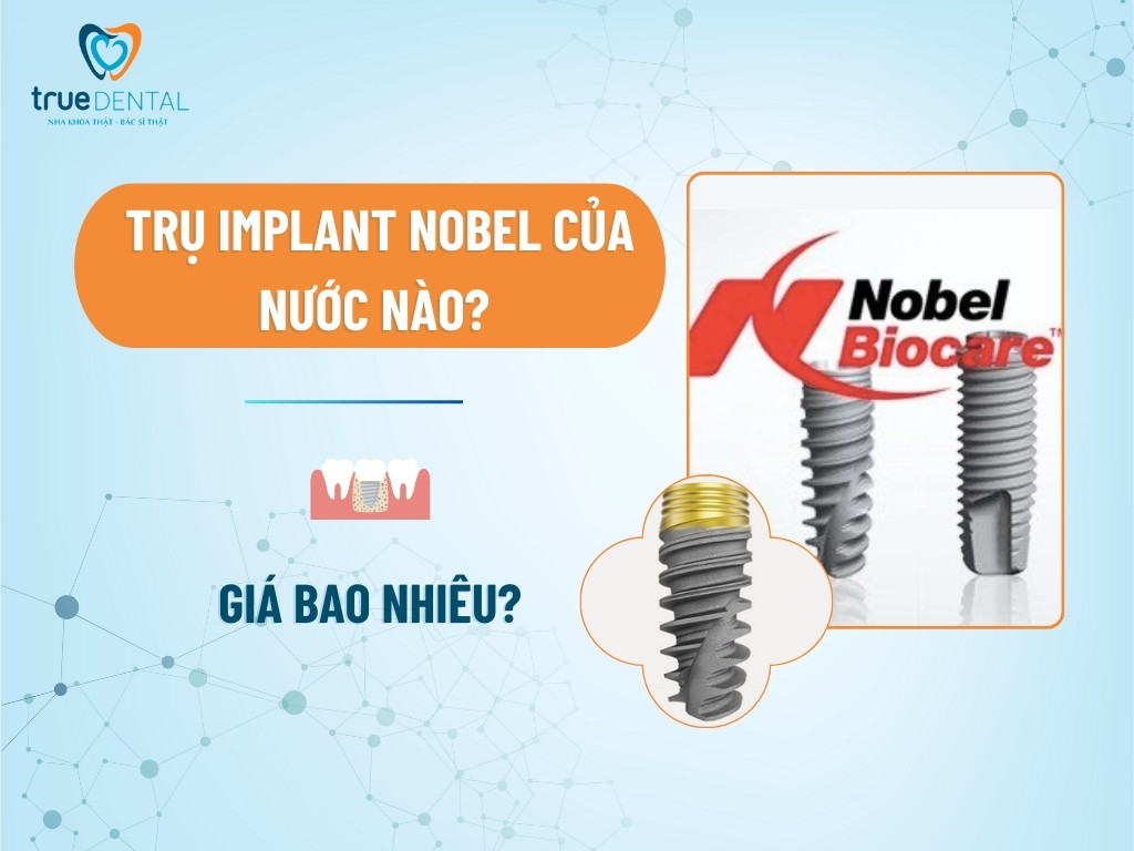 Trụ Implant Nobel của nước nào? Giá bao nhiêu?