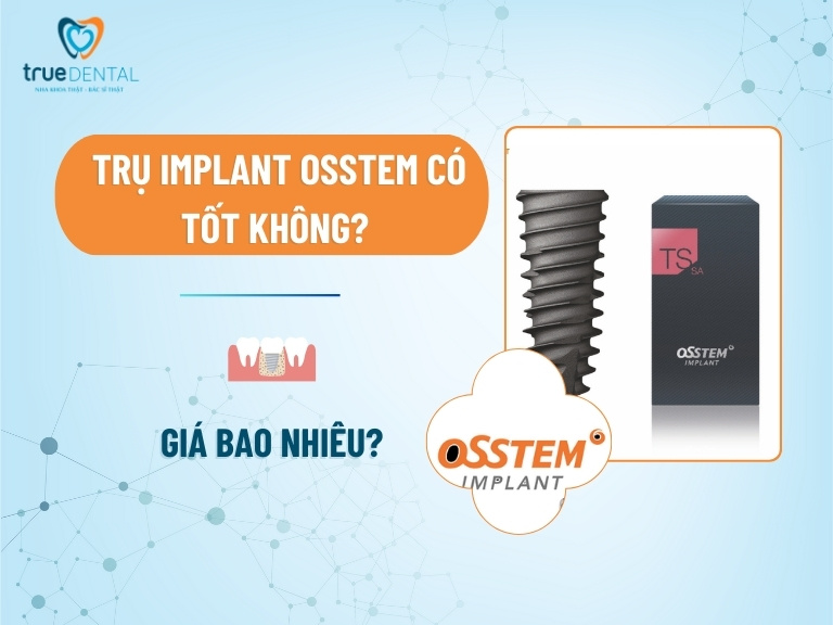 Trụ Implant Osstem có tốt không? Giá bao nhiêu?