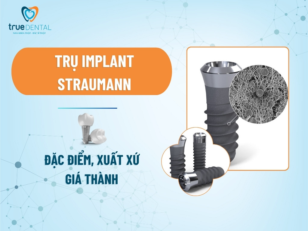 Trụ Implant Straumann: Đặc điểm, xuất xứ và giá thành