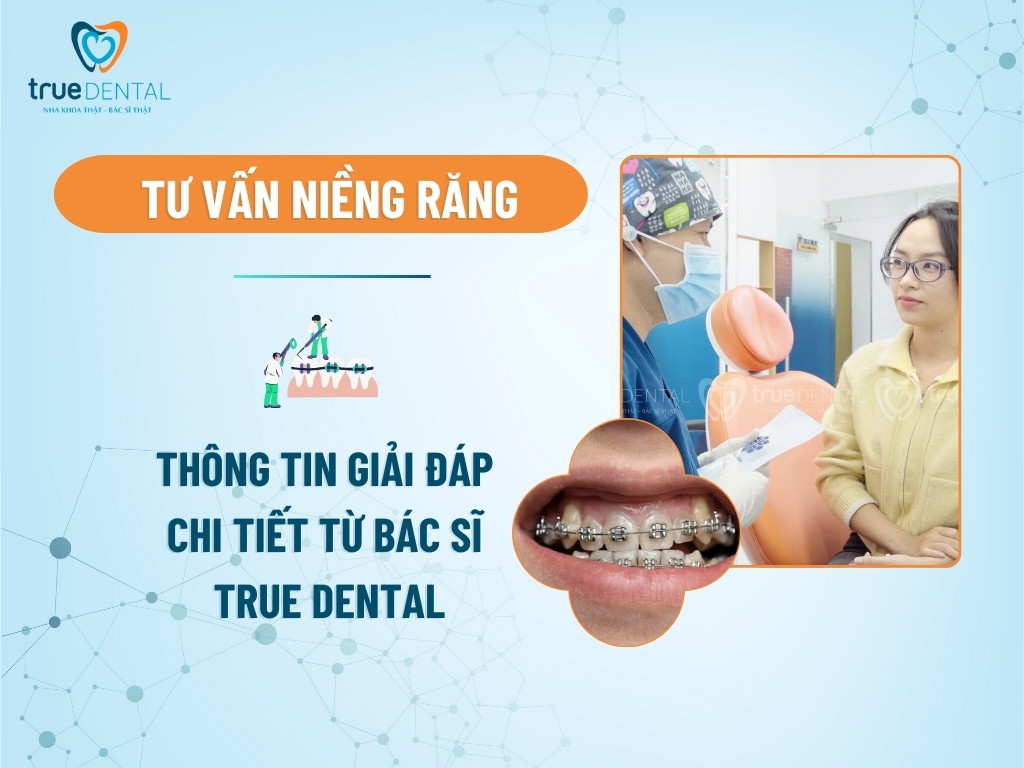 Tư vấn niềng răng - Thông tin giải đáp chi tiết từ Bác sĩ True Dental 7 Tư vấn niềng răng - Thông tin giải đáp chi tiết từ Bác sĩ True Dental