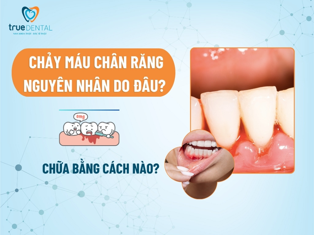 chay mau chan rang 1
