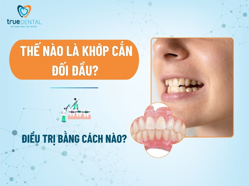 Thế nào là khớp cắn đối đầu? Điều trị bằng cách nào?