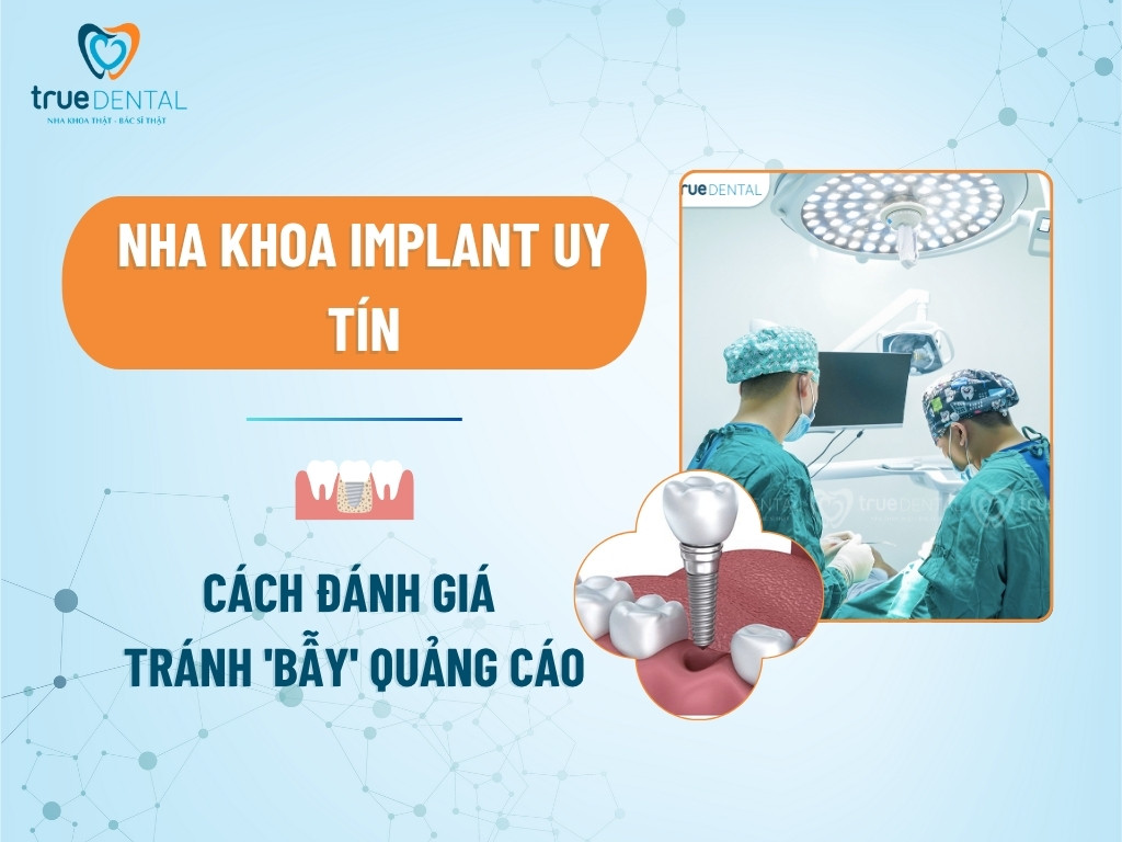 Nha Khoa Implant Uy Tín: Cách Đánh Giá Và Tránh 'Bẫy' Quảng Cáo